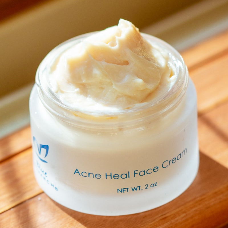 An open jar of Acne Heal Face Cream from Blue Monarch, a face cream for pimples, showing its rich, creamy texture under natural sunlight.